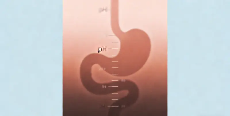 胃癌分子分型基因检测项目（组织）图3